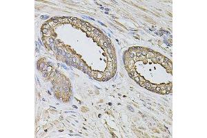 Immunohistochemistry of paraffin-embedded human prostate using S100A12 antibody. (S100A12 anticorps  (AA 1-92))
