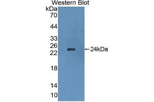 Detection of Recombinant APOB, Rat using Polyclonal Antibody to Apolipoprotein B (APOB) (APOB anticorps  (AA 2747-2913))