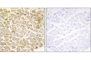 Immunohistochemistry analysis of paraffin-embedded human heart tissue, using CDH13 Antibody.