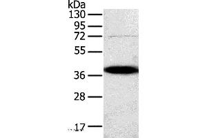 Western blot analysis of A375 cell, using SPARC Polyclonal Antibody at dilution of 1:500 (SPARC anticorps)