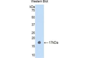 Western blot analysis of the recombinant protein. (LEFTY2 anticorps  (AA 247-358))