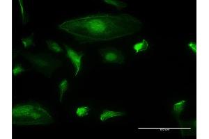 Immunofluorescence of monoclonal antibody to TRIM17 on HeLa cell. (TRIM17 / RNF16 anticorps  (AA 75-184))