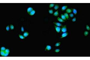 Immunofluorescent analysis of PC-3 cells using ABIN7155274 at dilution of 1:100 and Alexa Fluor 488-congugated AffiniPure Goat Anti-Rabbit IgG(H+L) (KAT5 anticorps  (AA 3-512))