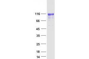 Validation with Western Blot