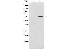 Western blot analysis of MMP 2 expression in LOVO cells. (MMP2 anticorps)