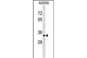 ACP5 Antibody (N-term) (ABIN1881042 and ABIN2838928) western blot analysis in  cell line lysates (35 μg/lane). (ACP5 anticorps  (N-Term))