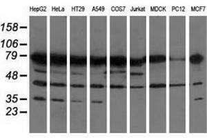 Western blot analysis of extracts (35 µg) from 9 different cell lines by using anti-PUS7 monoclonal antibody. (PUS7 anticorps)
