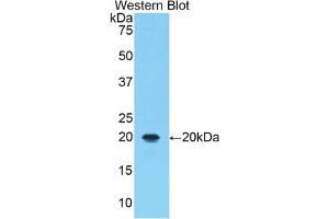 Western blot analysis of the recombinant protein. (ALOX5 anticorps  (AA 374-536))