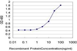 anti-Stathmin-Like 2 (STMN2) (AA 1-90) antibody