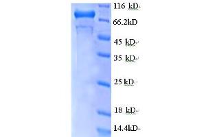SDS-PAGE (SDS) image for GDP Dissociation Inhibitor 2 (GDI2) (AA 1-441), (partial) protein (GST tag) (ABIN5712095)