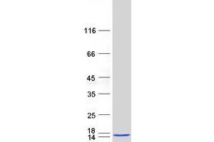 Validation with Western Blot