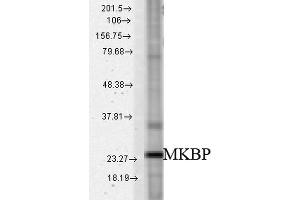 Western blot analysis of Rat tissue mix showing detection of HSPB2 protein using Rabbit Anti-HSPB2 Polyclonal Antibody . (HSPB2 anticorps  (Biotin))