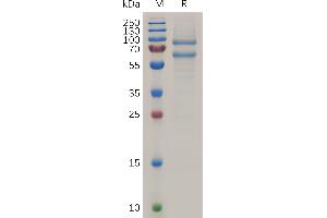 Human  A Protein, His Tag on SDS-PAGE under reducing condition.