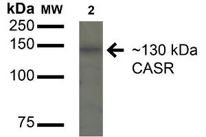 Western blot analysis of Rat Kidney cell lysates showing detection of 130kDa Calcium Sensing Receptor protein using Rabbit Anti-Calcium Sensing Receptor Polyclonal Antibody . (CASR anticorps  (AA 1-100) (Biotin))