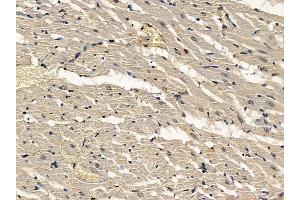 ABIN7094352 and ABIN7098399 at 1/100 staining rat heart tissue by IHC-P. (MEIS2 anticorps  (C-Term))