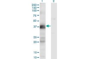 Western Blot analysis of EDNRA expression in transfected 293T cell line by EDNRA monoclonal antibody (M02), clone 2A5. (Endothelin-1 Receptor anticorps  (AA 18-80))