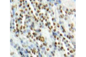 Used in DAB staining on fromalin fixed paraffin-embedded Kidney tissue