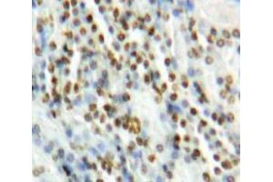 Used in DAB staining on fromalin fixed paraffin-embedded Kidney tissue (MAPK7 anticorps  (AA 560-793))