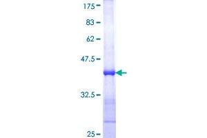Image no. 1 for LIM Domain Kinase 1 (LIMK1) (AA 548-647) protein (GST tag) (ABIN1309436)