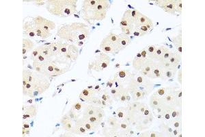 Immunohistochemistry of paraffin-embedded Human stomach using RAB3IP Polyclonal Antibody at dilution of 1:100 (40x lens). (RAB3IP anticorps)