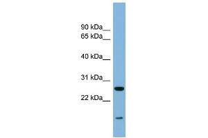 WB Suggested Anti-TRAPPC4 Antibody Titration: 0. (TRAPPC4 anticorps  (Middle Region))