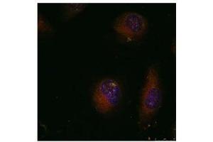 Image no. 3 for anti-Jun Proto-Oncogene (JUN) (AA 89-93) antibody (ABIN197129) (C-JUN anticorps  (AA 89-93))