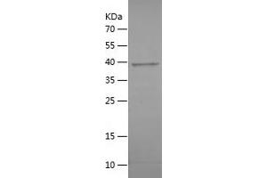 Western Blotting (WB) image for Anaphase Promoting Complex Subunit 15 (ANAPC15) (AA 1-121) protein (His-IF2DI Tag) (ABIN7121823)