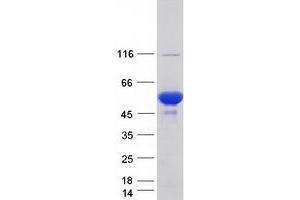 Validation with Western Blot