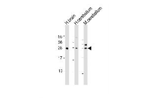 Western Blot at 1:1000-1:2000 dilution Lane 1: human brain lysate Lane 2: human cerebellum lysate Lane 3: mouse cerebellum lysate Lysates/proteins at 20 ug per lane. (KCTD11 anticorps  (AA 21-53))