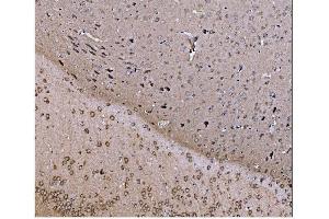 IHC analysis of JAB1 using anti-JAB1 antibody (ABIN7602482). (COPS5 anticorps  (AA 8-334))