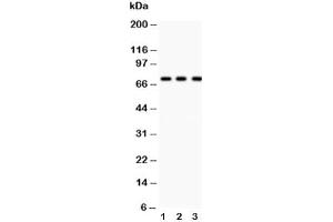 Western blot testing of p73 antibody and Lane 1:  COLO320