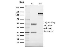 SDS-PAGE Analysis Purified Cytokeratin 20 (KRT20) Mouse Monoclonal Antibody (SPM140).