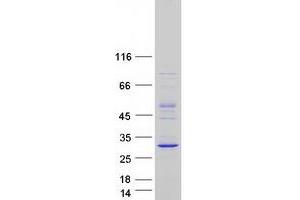 Validation with Western Blot