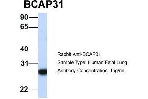 Host:  Rabbit  Target Name:  BCAP31  Sample Type:  Human Fetal Lung  Antibody Dilution:  1. (BCAP31 anticorps  (Middle Region))