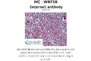 Image no. 3 for anti-Wingless-Type MMTV Integration Site Family, Member 5B (WNT5B) (Internal Region) antibody (ABIN1740832) (WNT5B anticorps  (Internal Region))