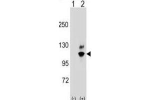 Western Blotting (WB) image for anti-Guanine Nucleotide Binding Protein Like Protein 2 (GNL2) antibody (ABIN2998762)