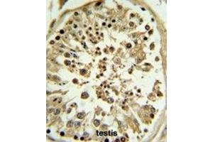 Immunohistochemistry (IHC) image for anti-Apolipoprotein L, 4 (APOL4) antibody (ABIN3002795)