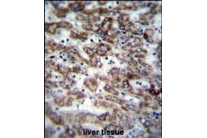 GCDH Antibody immunohistochemistry analysis in formalin fixed and paraffin embedded human liver tissue followed by peroxidase conjugation of the secondary antibody and DAB staining. (GCDH anticorps  (C-Term))
