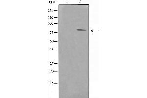 Western blot analysis on Jurkat cell lysate using FER Antibody，The lane on the left is treated with the antigen-specific peptide.