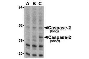 Immunohistochemistry (IHC) image for anti-Caspase 2, Apoptosis-Related Cysteine Peptidase (CASP2) (N-Term) antibody (ABIN1031296) (Caspase 2 anticorps  (N-Term))