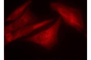 Immunofluorescence staining of methanol-fixed HeLa cells using Phospho-G3BP1-S232 antibody (ABIN2988019). (G3BP1 anticorps  (pSer232))