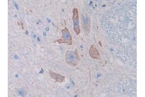 DAB staining on IHC-P; Samples: Rat Spinal cord Tissue (SPTAN1 anticorps  (AA 1571-1712))