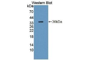 Detection of Recombinant CDK18, Human using Polyclonal Antibody to Cyclin Dependent Kinase 18 (CDK18) (CDK18 anticorps  (AA 144-425))
