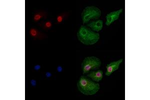 Phospho-Dnmt1 (Ser714) Antibody staining Hela cells(heat shock treatment) by IF/ICC. (DNMT1 anticorps  (pSer714))