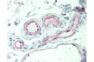 Human Small Intestine, Vessels: Formalin-Fixed, Paraffin-Embedded (FFPE) (Thrombomodulin anticorps  (C-Term))