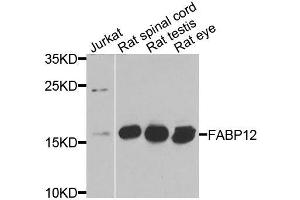 Western blot analysis of extracts of various cell lines, using FABP12 antibody (ABIN6003626) at 1/1000 dilution. (FABP12 anticorps)