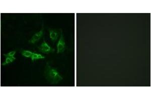 Immunofluorescence analysis of A549 cells, using GNRHR Antibody. (GNRHR anticorps  (AA 41-90))