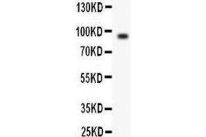 Anti- Periostin antibody, Western blotting All lanes: Anti Periostin  at 0. (Periostin anticorps  (N-Term))