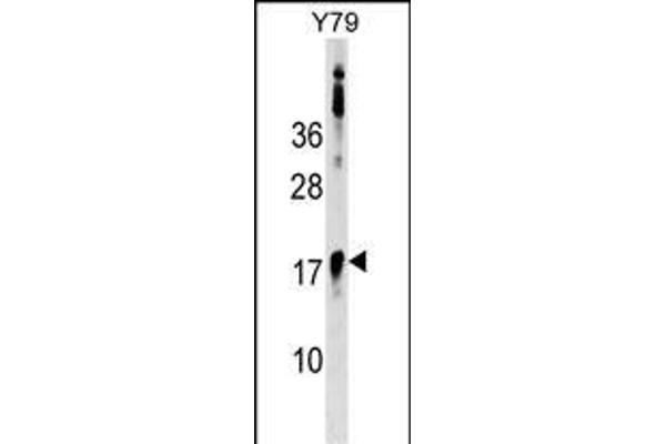 BCL7B antibody  (C-Term)