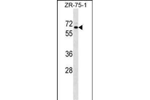 SRPR Antibody (C-term) (ABIN1537353 and ABIN2849199) western blot analysis in ZR-75-1 cell line lysates (35 μg/lane).